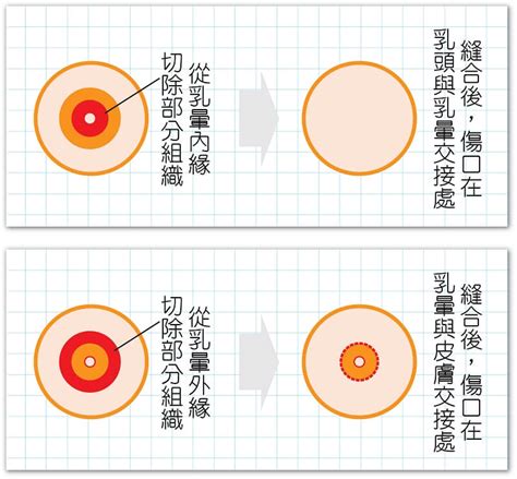 乳頭 長毛|乳暈長毛有危害嗎 – 易康網